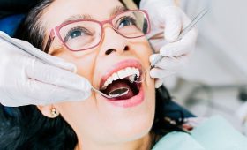 Patient,Checked,By,Dentist,,Close,Up,Of,Dentist,With,Patient,